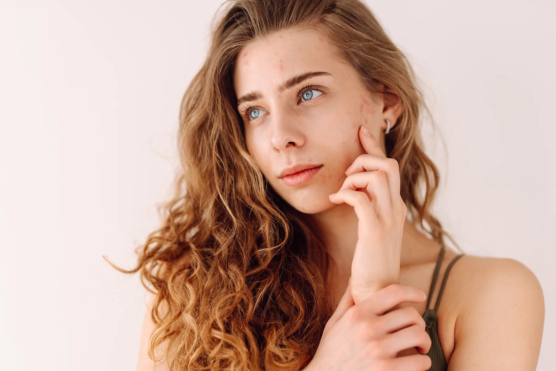 Pimples: Right and Wrong Ways to Tame Them